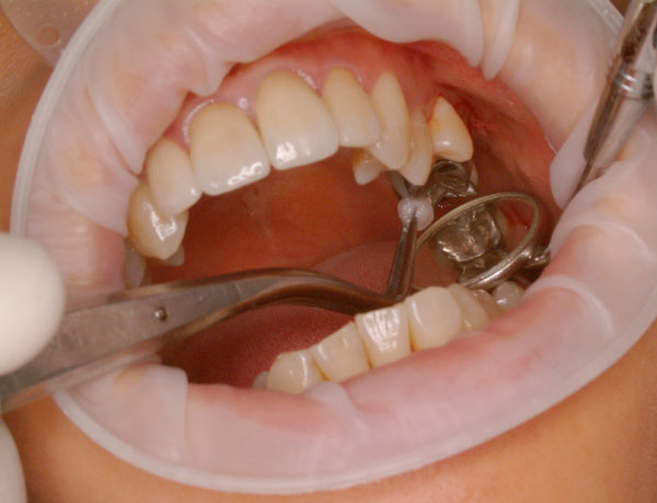 images/dentysta6.jpgd22af.jpg