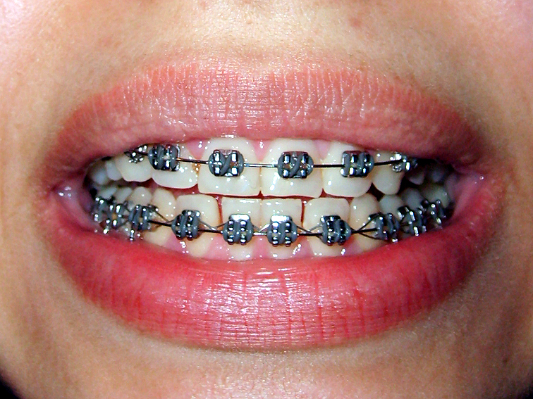 images/ortodonta.jpg149c1.jpg